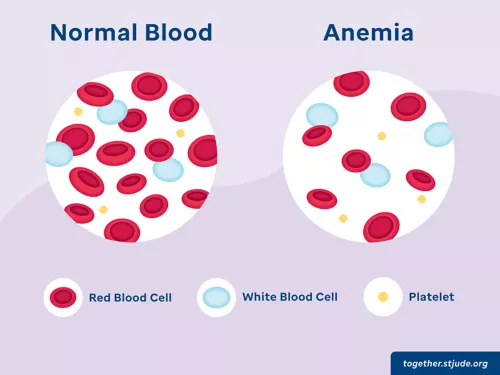 Anemia - Smart Kidney